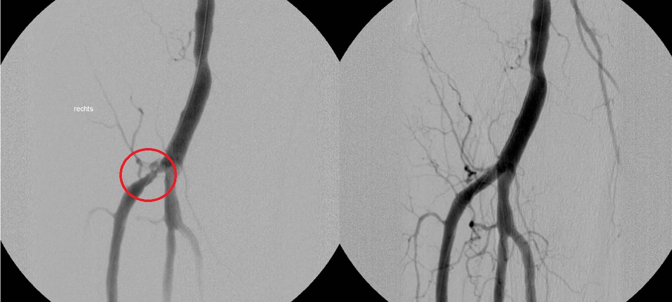 Weltweite OP-Premiere in Münster