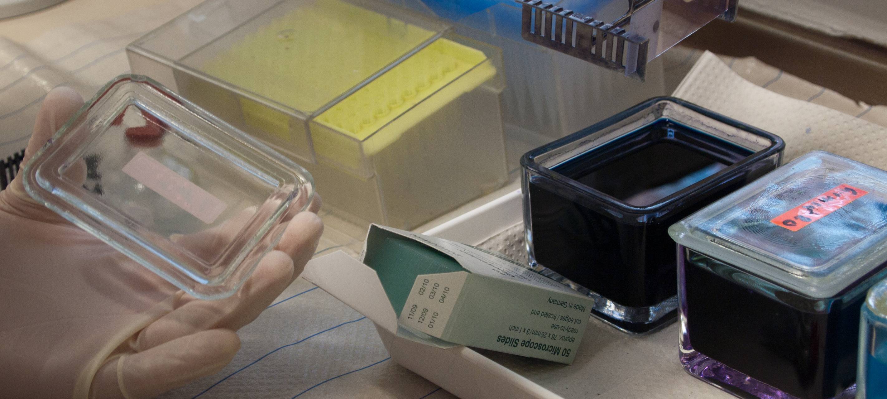 Kostenlose Corona-Schnelltests für alle