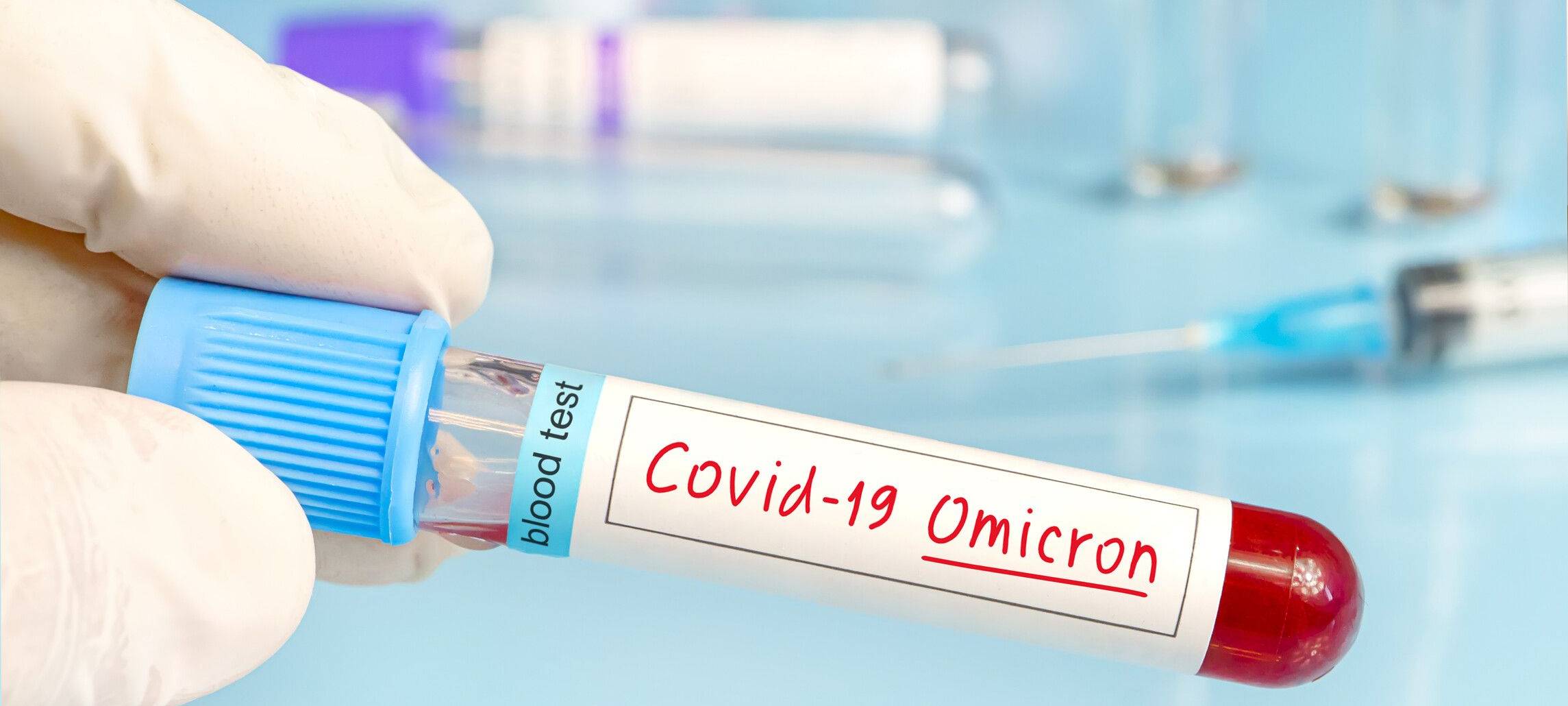 Hier bleiben Corona-Tests in Münster kostenlos