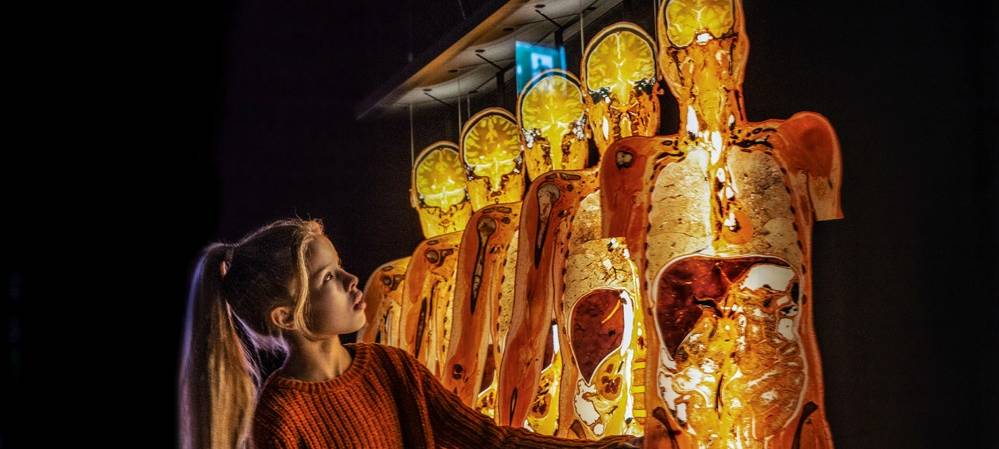 "Körperwelten" kommt nach Münster