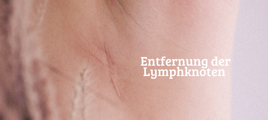 Projekt zur Krebsvorsorge