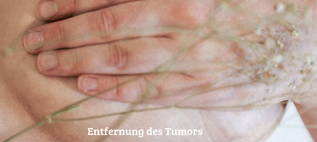 Projekt zur Krebsvorsorge